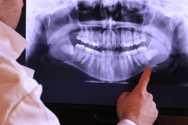Best Emergency Gum Treatment in Gettysburg, PA