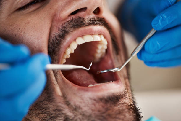 Best Emergency Tooth Extraction in Gettysburg, PA