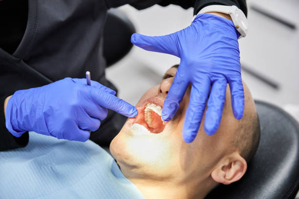 Best Emergency Root Canal Treatment in Gettysburg, PA