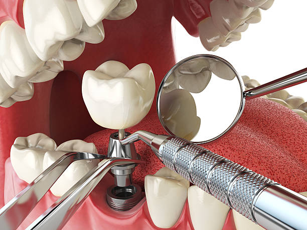 Best Emergency Denture Repair in Gettysburg, PA